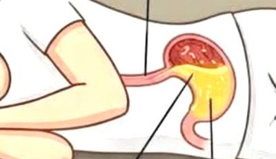 Note that if you always sleep on your right side
