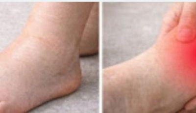 Infusion naturelle pour réduire le gonflement des jambes et des chevilles